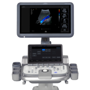 Siemens Healthineers ACUSON Juniper — representative model photo